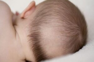 Trẻ sơ sinh bị rụng tóc